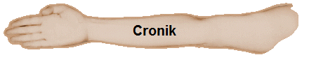 Cronik